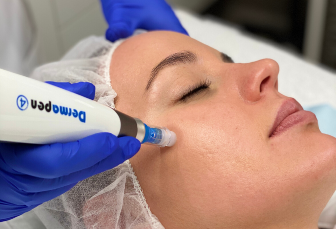 Medical Skin Needling